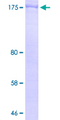 TLN1 / Talin 1 Protein - 12.5% SDS-PAGE Stained with Coomassie Blue