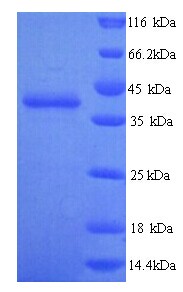 TLN2 / Talin 2 Protein