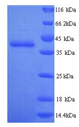 TLN2 / Talin 2 Protein