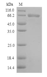 TLR1 Protein - (Tris-Glycine gel) Discontinuous SDS-PAGE (reduced) with 5% enrichment gel and 15% separation gel.