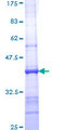 TLR1 Protein - 12.5% SDS-PAGE Stained with Coomassie Blue.