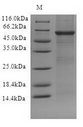 TLR10 Protein - (Tris-Glycine gel) Discontinuous SDS-PAGE (reduced) with 5% enrichment gel and 15% separation gel.