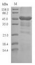 TLR10 Protein - (Tris-Glycine gel) Discontinuous SDS-PAGE (reduced) with 5% enrichment gel and 15% separation gel.