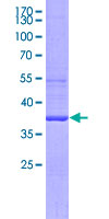 TLR10 Protein - 12.5% SDS-PAGE Stained with Coomassie Blue.