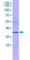 TLR10 Protein - 12.5% SDS-PAGE Stained with Coomassie Blue.