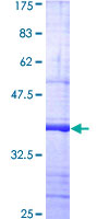 TLR2 Protein - 12.5% SDS-PAGE Stained with Coomassie Blue.