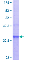 TLR2 Protein - 12.5% SDS-PAGE Stained with Coomassie Blue.