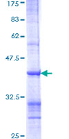 TLR3 Protein - 12.5% SDS-PAGE Stained with Coomassie Blue.