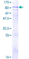TLR4 Protein - 12.5% SDS-PAGE of human TLR4 stained with Coomassie Blue