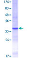 TLR4 Protein - 12.5% SDS-PAGE Stained with Coomassie Blue.