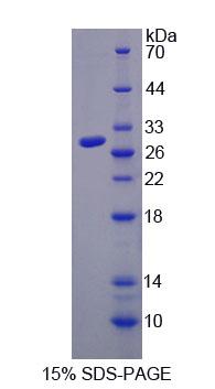 TLR4 Protein - Recombinant Toll Like Receptor 4 (TLR4) by SDS-PAGE