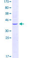TLR5 Protein - 12.5% SDS-PAGE Stained with Coomassie Blue.