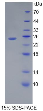 TLR5 Protein - Recombinant Toll Like Receptor 5 By SDS-PAGE