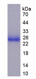 TLR5 Protein - Recombinant Toll Like Receptor 5 By SDS-PAGE