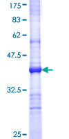 TLR6 Protein - 12.5% SDS-PAGE Stained with Coomassie Blue.