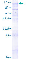 TLR8 Protein - 12.5% SDS-PAGE of human TLR8 stained with Coomassie Blue