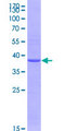 TLR8 Protein - 12.5% SDS-PAGE Stained with Coomassie Blue.