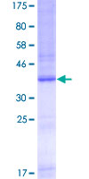 TLR9 Protein - 12.5% SDS-PAGE Stained with Coomassie Blue.