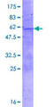 TLX2 / NCX Protein - 12.5% SDS-PAGE of human TLX2 stained with Coomassie Blue