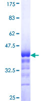 TLX3 Protein - 12.5% SDS-PAGE Stained with Coomassie Blue.