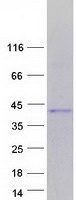 TLX3 Protein - Purified recombinant protein TLX3 was analyzed by SDS-PAGE gel and Coomassie Blue Staining