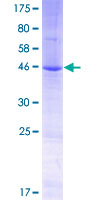 TM2D3 Protein - 12.5% SDS-PAGE of human TM2D3 stained with Coomassie Blue