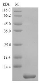 TM4SF1 Protein - (Tris-Glycine gel) Discontinuous SDS-PAGE (reduced) with 5% enrichment gel and 15% separation gel.