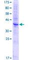 TM4SF1 Protein - 12.5% SDS-PAGE of human TM4SF1 stained with Coomassie Blue