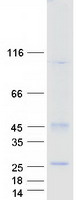 TM4SF19 Protein - Purified recombinant protein TM4SF19 was analyzed by SDS-PAGE gel and Coomassie Blue Staining