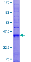 TM4SF4 Protein - 12.5% SDS-PAGE of human TM4SF4 stained with Coomassie Blue