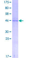 TM4SF6 / TSPAN6 Protein - 12.5% SDS-PAGE of human TSPAN6 stained with Coomassie Blue