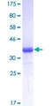 TM4SF6 / TSPAN6 Protein - 12.5% SDS-PAGE Stained with Coomassie Blue.