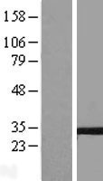 TM4SF9 / TSPAN5 Protein - Western validation with an anti-DDK antibody * L: Control HEK293 lysate R: Over-expression lysate