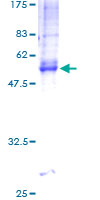 TM4SF9 / TSPAN5 Protein - 12.5% SDS-PAGE of human TSPAN5 stained with Coomassie Blue