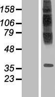TM6SF1 Protein - Western validation with an anti-DDK antibody * L: Control HEK293 lysate R: Over-expression lysate