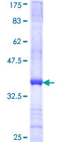 TM9SF2 Protein - 12.5% SDS-PAGE Stained with Coomassie Blue.