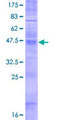 TMBIM6 / Bax Inhibitor 1 Protein - 12.5% SDS-PAGE of human TEGT stained with Coomassie Blue