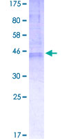 TMBIM6 / Bax Inhibitor 1 Protein - 12.5% SDS-PAGE of human TMBIM6 stained with Coomassie Blue
