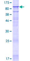 TMC4 Protein - 12.5% SDS-PAGE of human TMC4 stained with Coomassie Blue