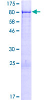 TMC7 Protein - 12.5% SDS-PAGE of human TMC7 stained with Coomassie Blue