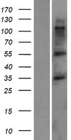 TMCC3 Protein - Western validation with an anti-DDK antibody * L: Control HEK293 lysate R: Over-expression lysate