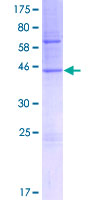 TMCO1 Protein - 12.5% SDS-PAGE of human TMCO1 stained with Coomassie Blue