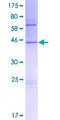 TMCO1 Protein - 12.5% SDS-PAGE of human TMCO1 stained with Coomassie Blue