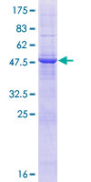 TMCO6 Protein - 12.5% SDS-PAGE of human TMCO6 stained with Coomassie Blue