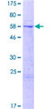 TMCO7 Protein - 12.5% SDS-PAGE of human TMCO7 stained with Coomassie Blue