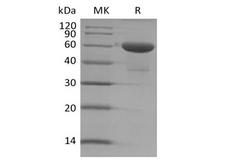 TMED1 / ST2L Protein - Recombinant Human TMED1 (C-Fc)