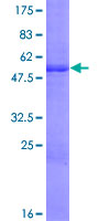 TMED1 / ST2L Protein - 12.5% SDS-PAGE of human TMED1 stained with Coomassie Blue