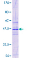 TMED1 / ST2L Protein - 12.5% SDS-PAGE Stained with Coomassie Blue.