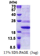 TMED10 / TMP21 Protein