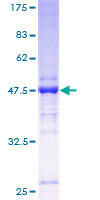 TMED2 Protein - 12.5% SDS-PAGE of human RNP24 stained with Coomassie Blue